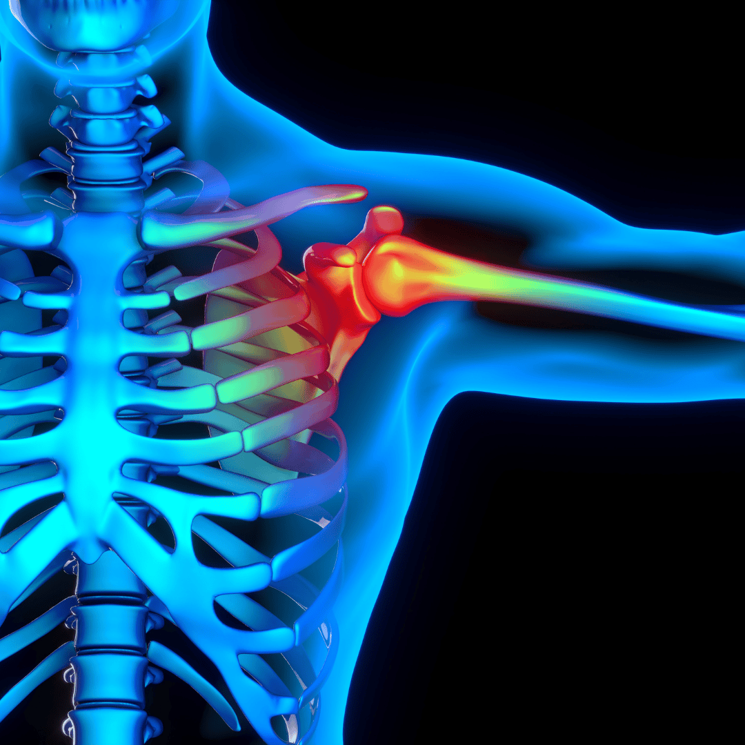 Consuming Organic Garlic May Improve Overall Bone Health